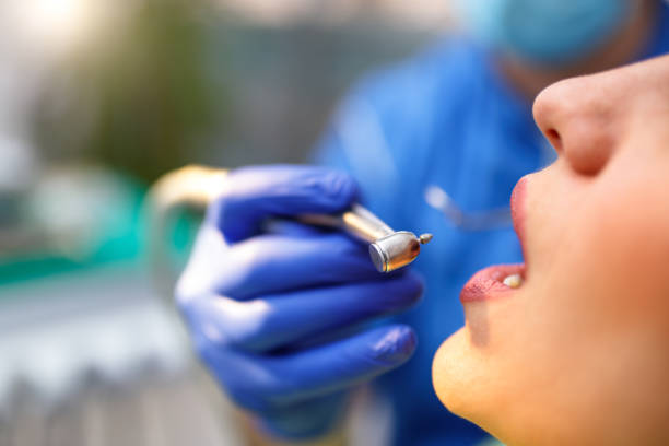 Dental Bonding in Bayshore Gardens, FL